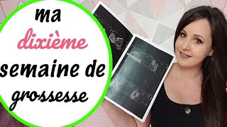 🍼 10ème semaine de grossesse échographie du premier trimestre  vidéo écho [upl. by Sylvanus]