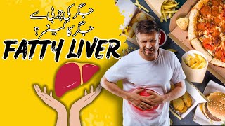 Home Remedies for Fatty Liver Prevent yourself [upl. by Danzig]