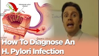 How To Diagnose An H Pylori Infection [upl. by Solegnave]