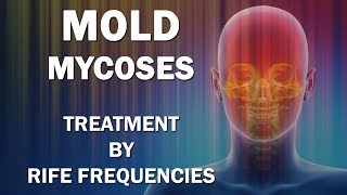 Mold and Mycoses Fungus Diseases  RIFE Frequencies Treatment  Energy amp Quantum Medicine [upl. by Ttennej]