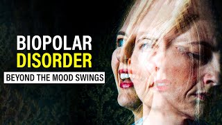 Bipolar Disorder  Mental Health  Healing Mind [upl. by Ttesil]