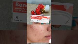 Benclin gel uses in Urdu Benclin gel for acne shorts benclingel removeacne [upl. by Leroj]