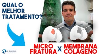 EROSÃO OSTEOCONDRAL Tratamento por microfraturas ou membrana de colágeno [upl. by Rhiana]