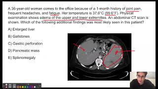 USMLE Step 1 Question of the Day 4 Felty Syndrome [upl. by Ewen]