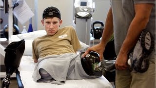 US soldier recovers after losing all four limbs [upl. by Ushijima]