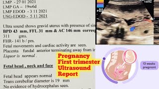 13 Week Pregnancy Ultrasound  First Ultrasound Report Kaise Padhe  3 Month Pregnancy Ultrasound [upl. by Michaelina418]