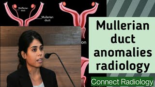 Mullerian duct anomalies radiology PART 2 [upl. by Heidt422]