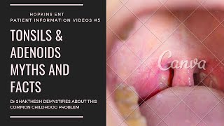 TONSIL AND ADENOID SURGERY MYTHS AND FACTS I TAMIL VERSION I PART 1 [upl. by Sholes774]