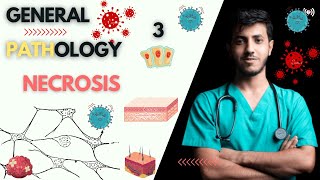 General Pathology Course  lecture 1  part 3  Necrosis  كورس علم الأمراض [upl. by Inatsed]