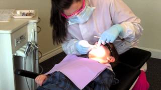 Silver Nitrate  Fluoride Varish Protocol [upl. by Ilrebmyk]