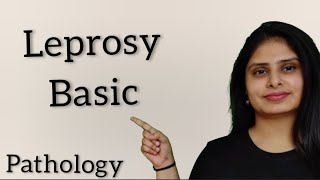 Leprosy in hindi  Leprosy pathology in hindi [upl. by Ellecram411]