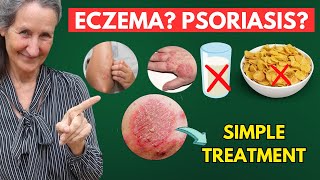 STOP Eating This To Cure all Your Skin Problems Like Eczema Psoriasis  Dr Barbara ONeill [upl. by Uthrop]