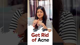 5 Habits to Get Rid of Acne  Get Rid of Acne [upl. by Acinorev836]