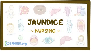 Jaundice Clinical Nursing Care [upl. by Selyn232]