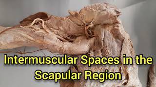 Intermuscular Spaces in the Scapular RegionQuadrangular Upper and Lower Triangular spaces [upl. by Akenet]