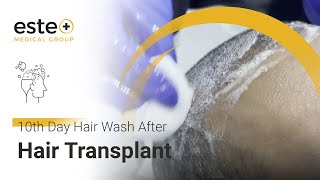 10th Day Hair Wash After Hair Transplant hairtransplantturkey estemedicalgroupistanbul [upl. by Farmer]