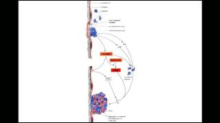 Fluid amp Haemodynamic derangements 2 [upl. by Idahs]