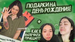 О НАБОЛЕВШЕМ  ЧТО ПОДАРИЛИ НА ДЕНЬ РОЖДЕНИЯ КАК Я ВЫЛЕЧИЛА ПРЫЩИ [upl. by Beckman]