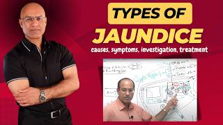 Types Of Jaundice  Causes Symptoms amp Treatment  Dr Najeeb [upl. by Nickerson]