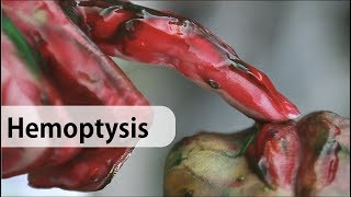 Hemoptysis causes diagnosis and management [upl. by Ivel68]