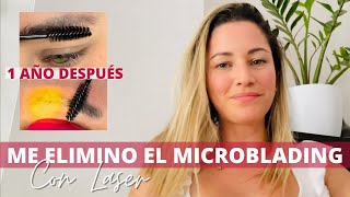 ME ELIMINO EL MICROBLADING DE CEJAS CON LASER 😱¿Por que ME QUITE el MICROBLADING un año después [upl. by Ydnamron]