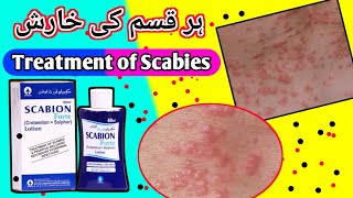 scabion forte lotion uses in urdu medicine [upl. by Anelav]