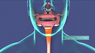 Indepth Esophageal cancer symptoms to look for and why it kills most who are diagnosed with it [upl. by Gnay]