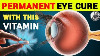 1 Vitamin to Cure Eye Problem Permanently  Eye care Tips  Vitamins eyecare [upl. by Eldrid]