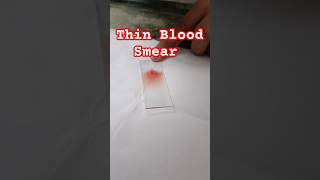 How to make peripheral thin blood smear smear blood staining microscopy hematology shorts [upl. by Eahsram]