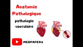 anatomie pathologique pathologie vasculaire [upl. by Gnilrets]