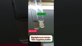 Tube coagulase test for Staphylococcus aureus staphylococcus tubecoagulase [upl. by Aniakudo]