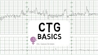 CTG Basics [upl. by Forster]