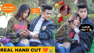 Hand Cut Prank  Prank On Girlfriend Gone Extremely Wrong 😱  Justin Romio [upl. by Delfine715]