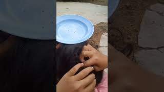 lice Removal part 12shots [upl. by Areta498]