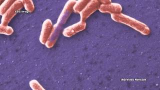 CarbapenemResistant Enterobacteriaceae CRE [upl. by Schuler]