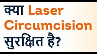 Reality of LASER CIRCUMCISION [upl. by Deborath]