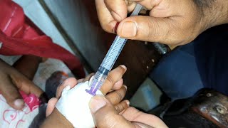 Child Meropenem 250mg amp Amikacin intravenous injection Video 24 Ep 71 Injection Tips [upl. by Rinee]