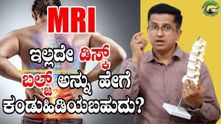 MRI ಇಲ್ಲದೇ ಡಿಸ್ಕ್ ಬಲ್ಜ್ ಅನ್ನು ಹೇಗೆ ಕಂಡುಹಿಡಿಯಬಹುದು [upl. by Robin444]