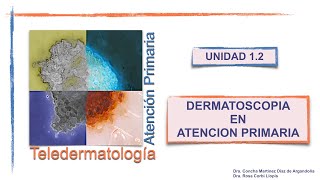 UNIDAD 12  INTRODUCCION DERMATOSCOPIA [upl. by Kindig886]