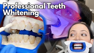 Teeth Whitening At The Dentist  Fastest Way To Whiten Your Teeth [upl. by Estele]