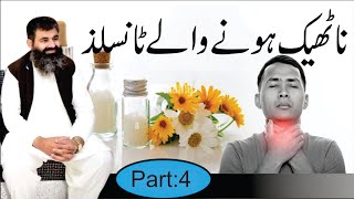 Tonsils  Causes amp treatment of Tonsils Infection  Homeopathic DRMMUNAWAR DAWOOD [upl. by Ogilvie718]