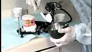 Complete Denture Procedure  21 CLINICAL REMOUNT AND OCCLUSAL REFINEMENTS [upl. by Matthus191]