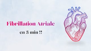 Fibrillation Atriale  Physiopathologie ECG [upl. by Ajnotal787]