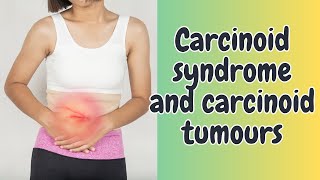 Carcinoid syndrome and carcinoid tumours [upl. by Mcafee]