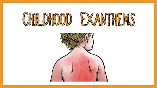 Childhood Exanthems rash [upl. by Eetsud]