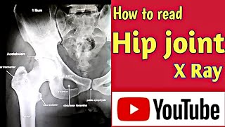 How to read Hip joint X Ray । Hip joint Anatomy । Uday Xray [upl. by Bevash]