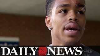 Deandre Harris who was savagely beaten in Charlottesville wanted in assault case [upl. by Perloff]