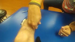 How to Fit and Use a Dyna Splint Ankle Brace for Equinus Contracture [upl. by Kant]