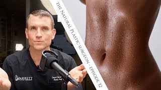 32 Everything You Need To Know About Liposuction [upl. by Skolnik]