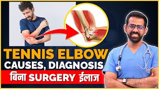 Tennis Elbow Lateral EpicondylitisCauses  Diagnosis  Non Surgical Treatment [upl. by Hartzke]